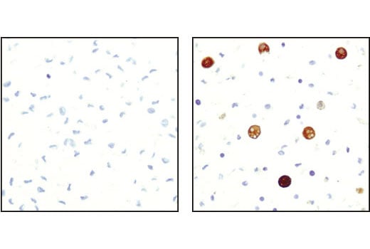 Immunohistochemistry Image 1: ATGL (30A4) Rabbit Monoclonal Antibody (BSA and Azide Free)