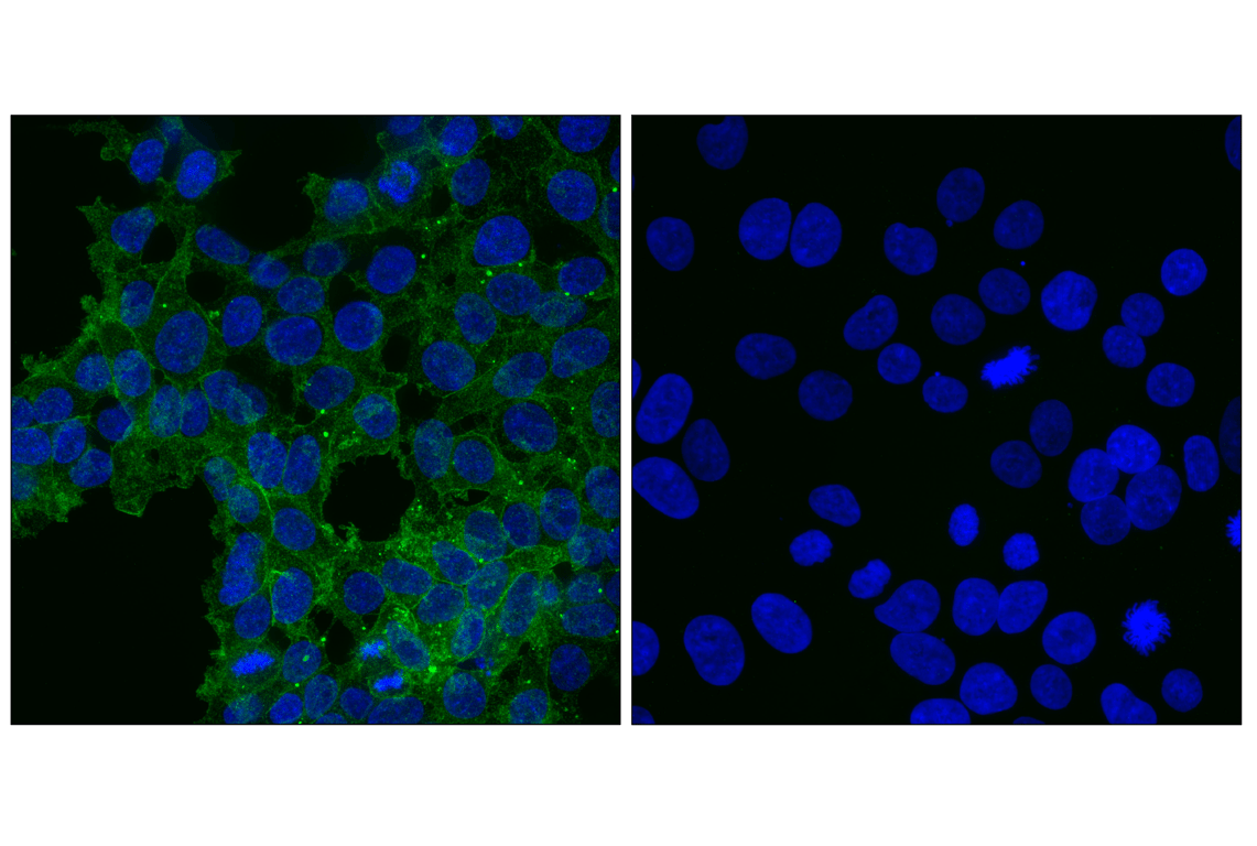 Immunofluorescence Image 1: RhoA (67B9) Rabbit Monoclonal Antibody