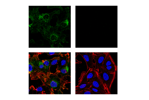 Immunofluorescence Image 1: CD10/Neprilysin (E9Z2W) Rabbit Monoclonal Antibody
