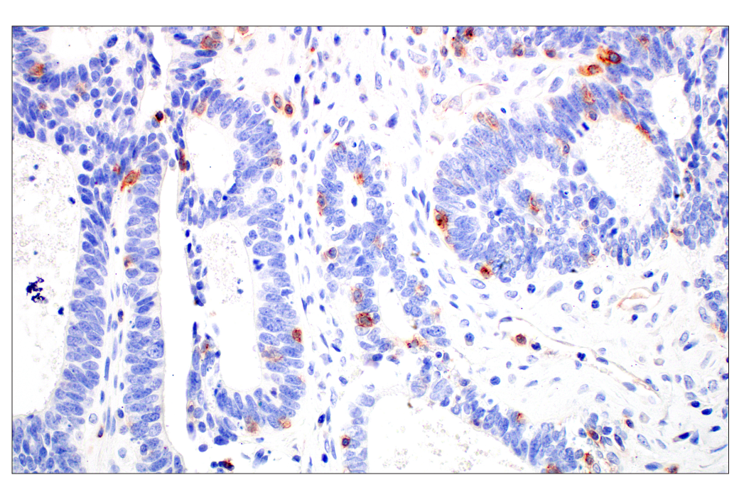 Immunohistochemistry Image 6: CD70 (E3Q1A) Rabbit Monoclonal Antibody
