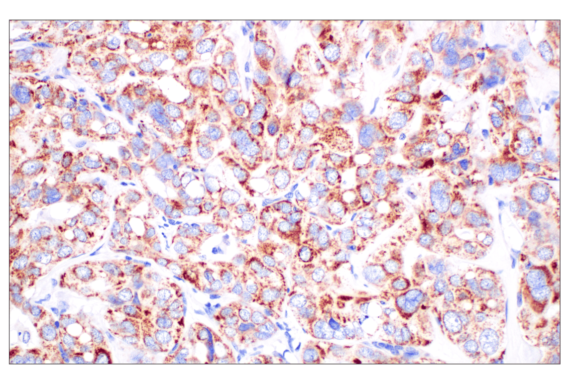 Immunohistochemistry Image 3: CPT1A (E3Y1V) Rabbit Monoclonal Antibody