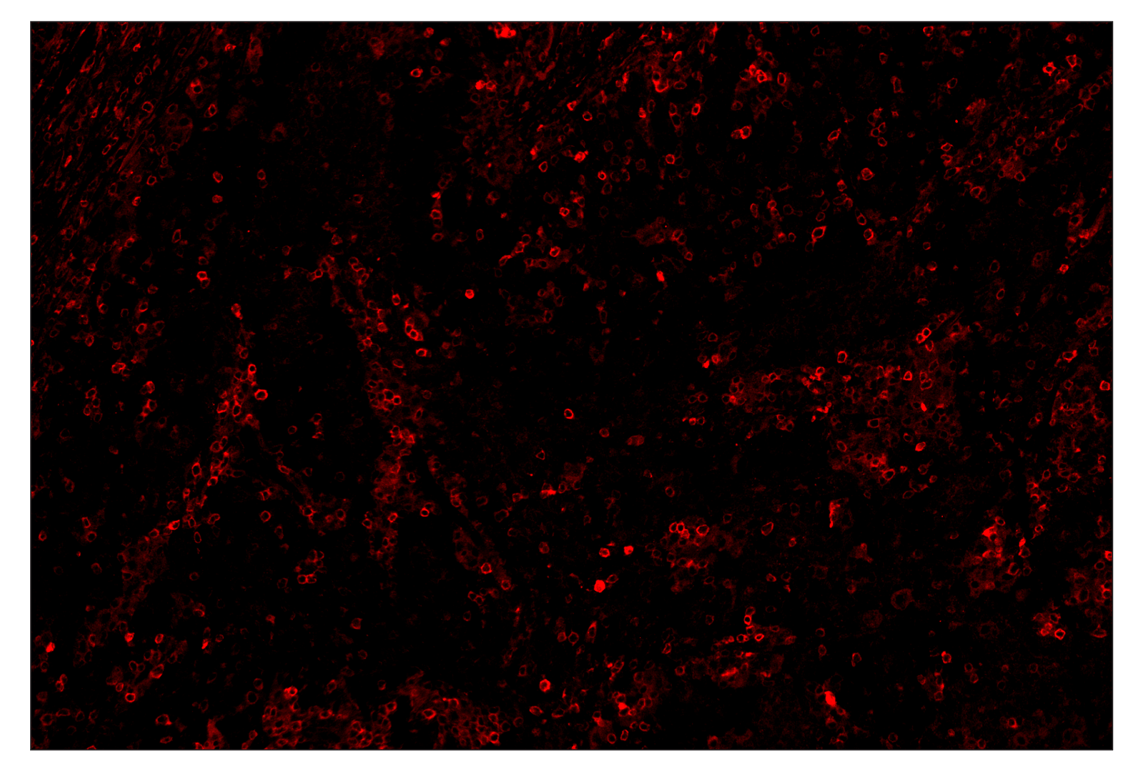 Immunohistochemistry Image 4: Phospho-SLP-76 (Ser376) (E3G9U) & CO-0018-488 SignalStar<sup>™</sup> Oligo-Antibody Pair