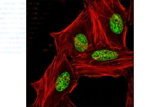 Immunofluorescence Image 1: Di-Methyl-Histone H3 (Lys9) (D85B4) Rabbit Monoclonal Antibody