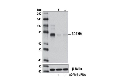 undefined Image 1: SignalSilence<sup>®</sup> ADAM9 siRNA I