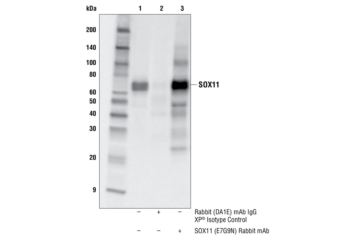 Immunoprecipitation Image 1: SOX11 (E7G9N) Rabbit Monoclonal Antibody
