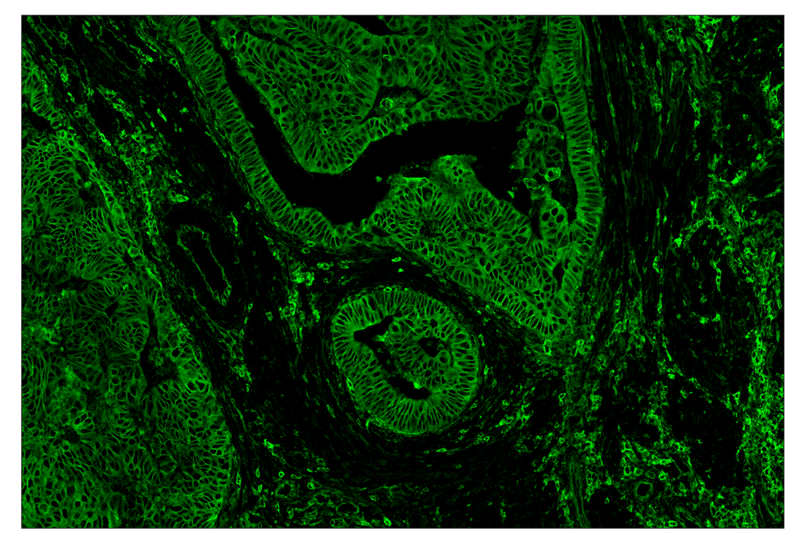 Immunohistochemistry Image 2: MHC Class I (EMR8-5) & CO-0082-647 SignalStar<sup>™</sup> Oligo-Antibody Pair