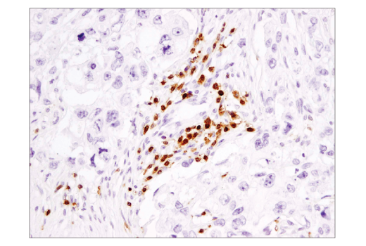 Immunohistochemistry Image 2: CD3 epsilon (D7A6E<sup>™</sup>) Rabbit Monoclonal Antibody (BSA and Azide Free)