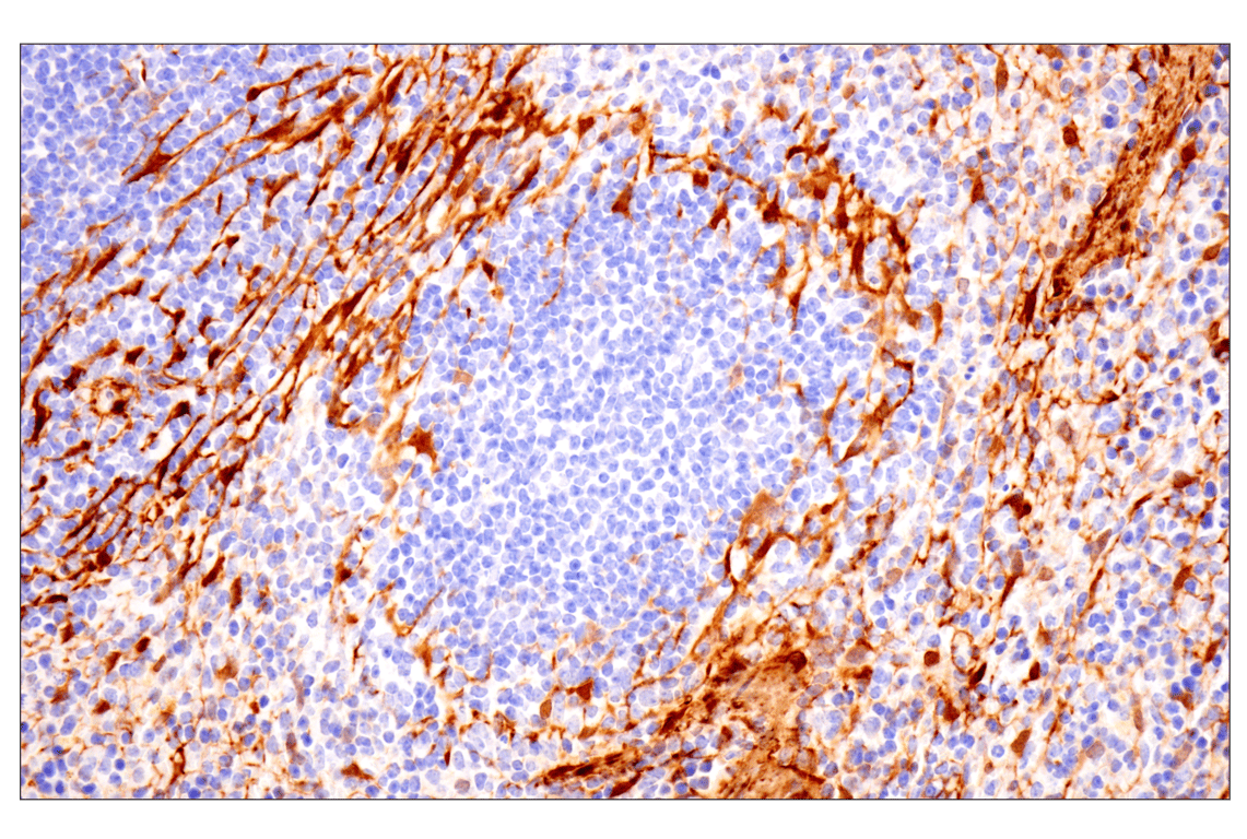 Immunohistochemistry Image 14: Transgelin/TAGLN (F3B7H) Rabbit Monoclonal Antibody