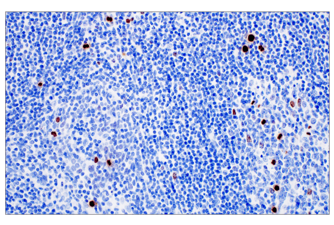 Immunohistochemistry Image 7: Phospho-Histone H3 (Ser10) (D7N8E) Rabbit Monoclonal Antibody (BSA and Azide Free)