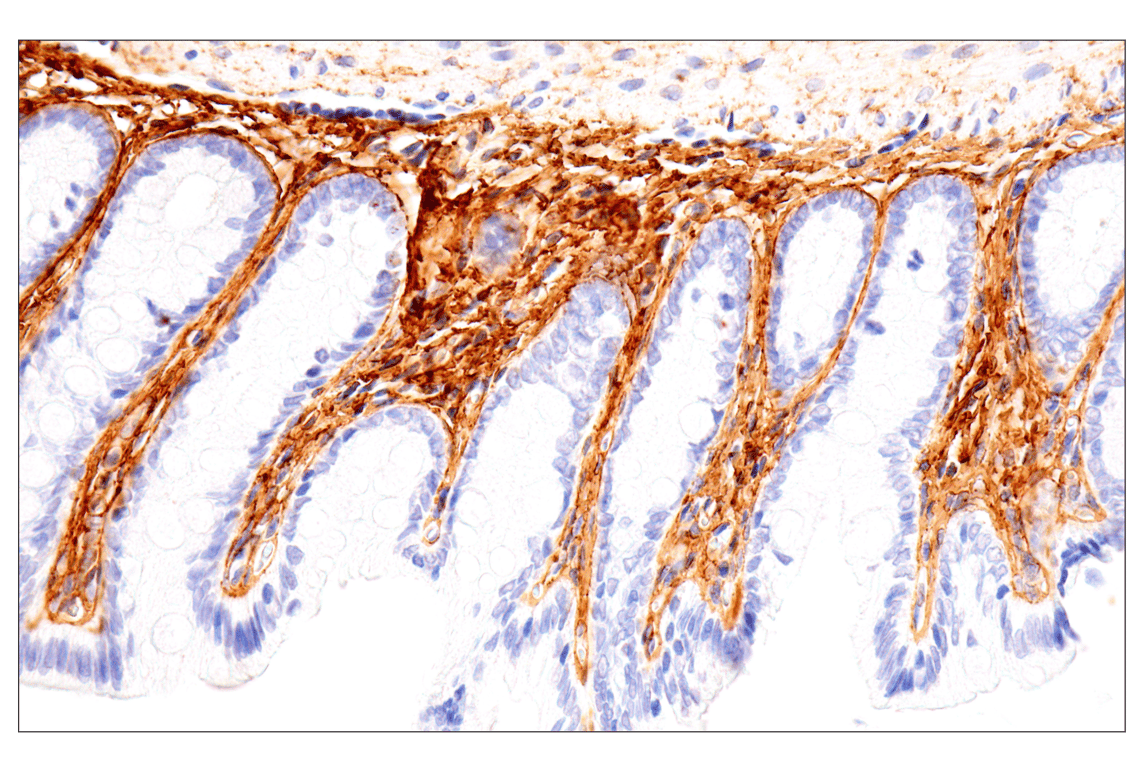 Immunohistochemistry Image 9: COL1A1 (E8F4L) Rabbit Monoclonal Antibody