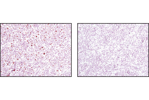 Immunohistochemistry Image 2: Phospho-Stat1 (Tyr701) (58D6) Rabbit Monoclonal Antibody (BSA and Azide Free)