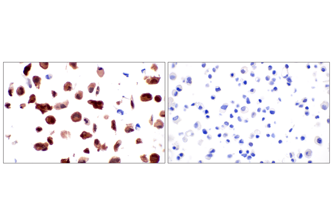 Immunohistochemistry Image 18: CDK6 (E3E3Q) Rabbit Monoclonal Antibody