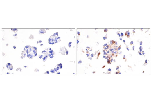 Immunohistochemistry Image 2: CXCL9/MIG (E6Z5W) Rabbit Monoclonal Antibody (BSA and Azide Free)