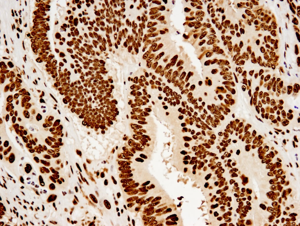 Immunohistochemistry Image 2: Nucleolin (D4C7O) Rabbit Monoclonal Antibody