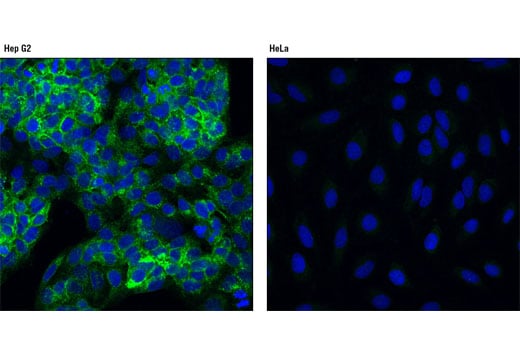 Immunofluorescence Image 1: FGF Receptor 4 (D3B12) XP<sup>®</sup> Rabbit mAb (BSA and Azide Free)