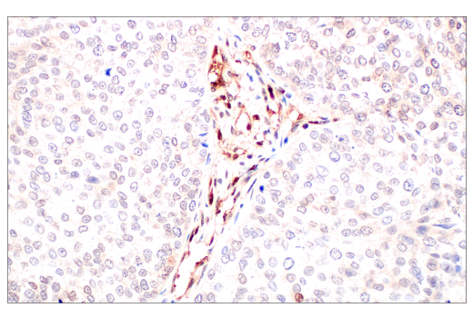 Immunohistochemistry Image 4: CRBN (D8H3S) Rabbit Monoclonal Antibody (BSA and Azide Free)