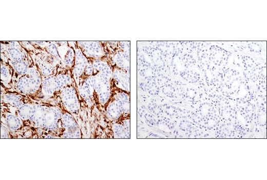 Immunohistochemistry Image 2: Gelsolin (D9W8Y) Rabbit Monoclonal Antibody
