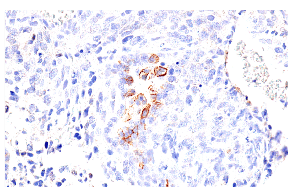 Immunohistochemistry Image 3: Syndecan 1 (E7F7T) Rabbit Monoclonal Antibody (BSA and Azide Free)