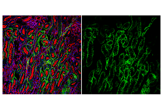 Immunofluorescence Image 3: AQP4 (D1F8E) Rabbit Monoclonal Antibody (Alexa Fluor<sup>®</sup> 488 Conjugate)
