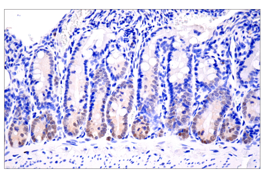 Immunohistochemistry Image 4: Tox/Tox2 (E6I3Q) Rabbit Monoclonal Antibody