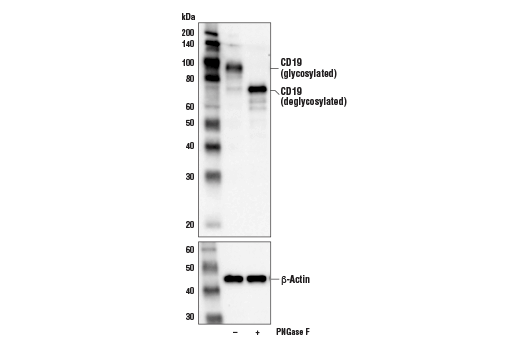 Western Blotting Image 2: CD19 (Intracellular Domain) (D4V4B) Rabbit Monoclonal Antibody