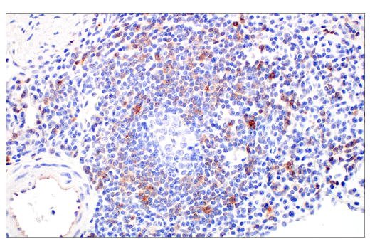 Immunohistochemistry Image 5: CD70 (E3Q1A) Rabbit Monoclonal Antibody (BSA and Azide Free)