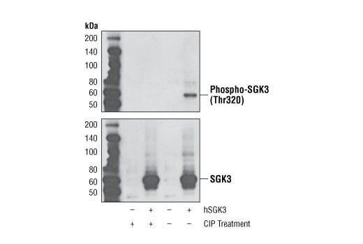 Western Blotting Image 1: Phospho-SGK3 (Thr320) (D30E6) Rabbit mAb