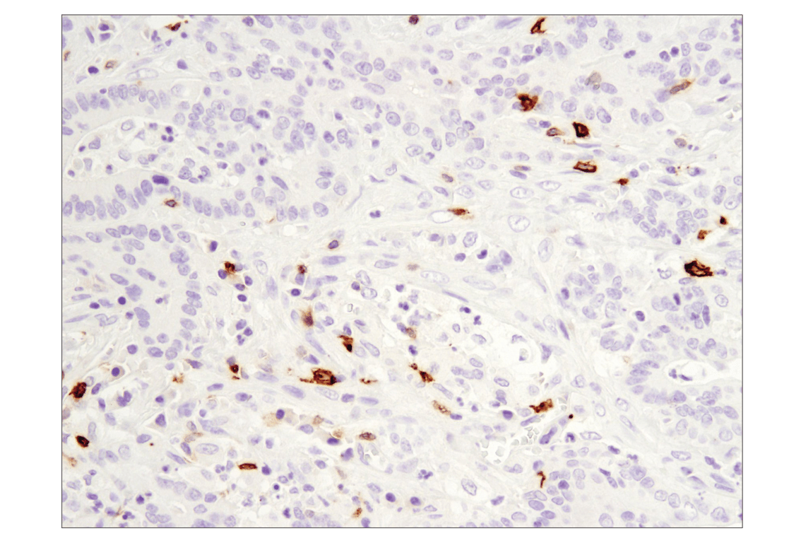 Immunohistochemistry Image 2: OX40 (E9U7O) Rabbit Monoclonal Antibody (BSA and Azide Free)
