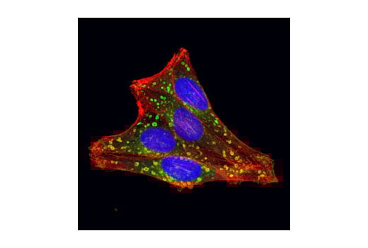 Immunofluorescence Image 1: Rab7 (D95F2) Rabbit Monoclonal Antibody (BSA and Azide Free)