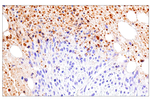 undefined Image 34: NETosis Antibody Sampler Kit