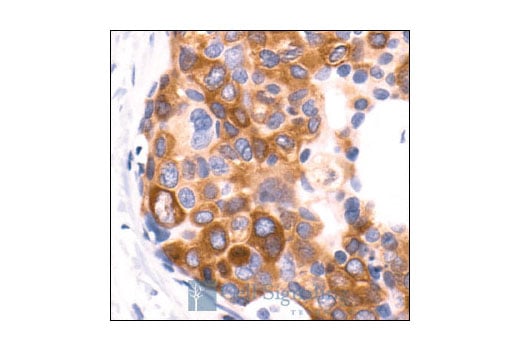 Immunohistochemistry Image 1: Phospho-Acetyl-CoA Carboxylase (Ser79) Antibody
