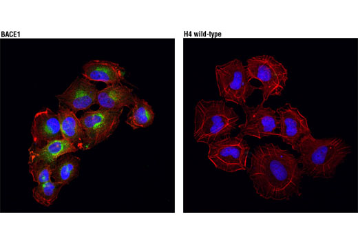 Immunofluorescence Image 1: BACE1 (D10E5) Rabbit Monoclonal Antibody (BSA and Azide Free)