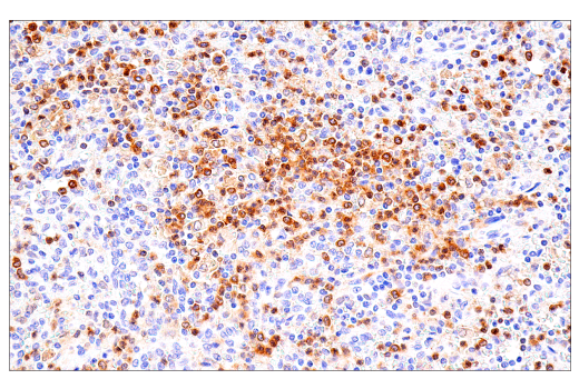 Immunohistochemistry Image 7: DAP12 (E8P9U) Rabbit Monoclonal Antibody (BSA and Azide Free)