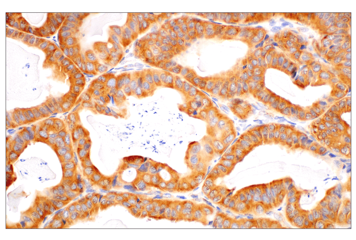 Immunohistochemistry Image 2: RACK1 (D59D5) Rabbit Monoclonal Antibody (BSA and Azide Free)