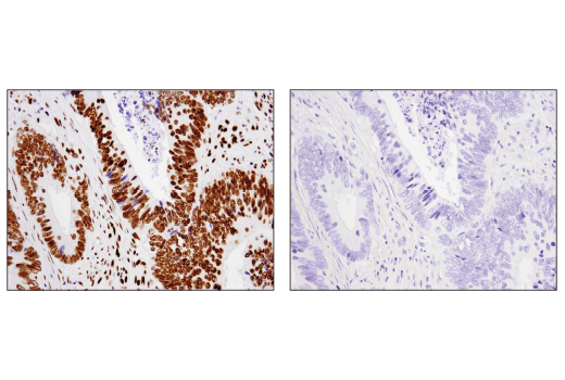 Immunohistochemistry Image 3: Acetyl-Histone H2B (Lys20) (D7O9W) Rabbit Monoclonal Antibody