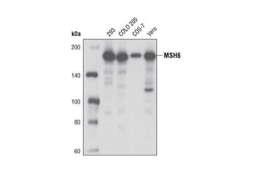 undefined Image 4: Mismatch DNA Repair (MMR) Antibody Sampler Kit