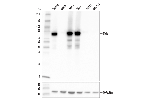 Western Blotting Image 1: Syk (4D10) Mouse Monoclonal Antibody