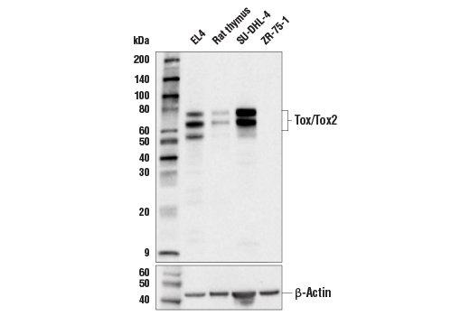 アポカリプト('06米) Androgen receptor Recombinant Rabbit Monoclonal Antibody