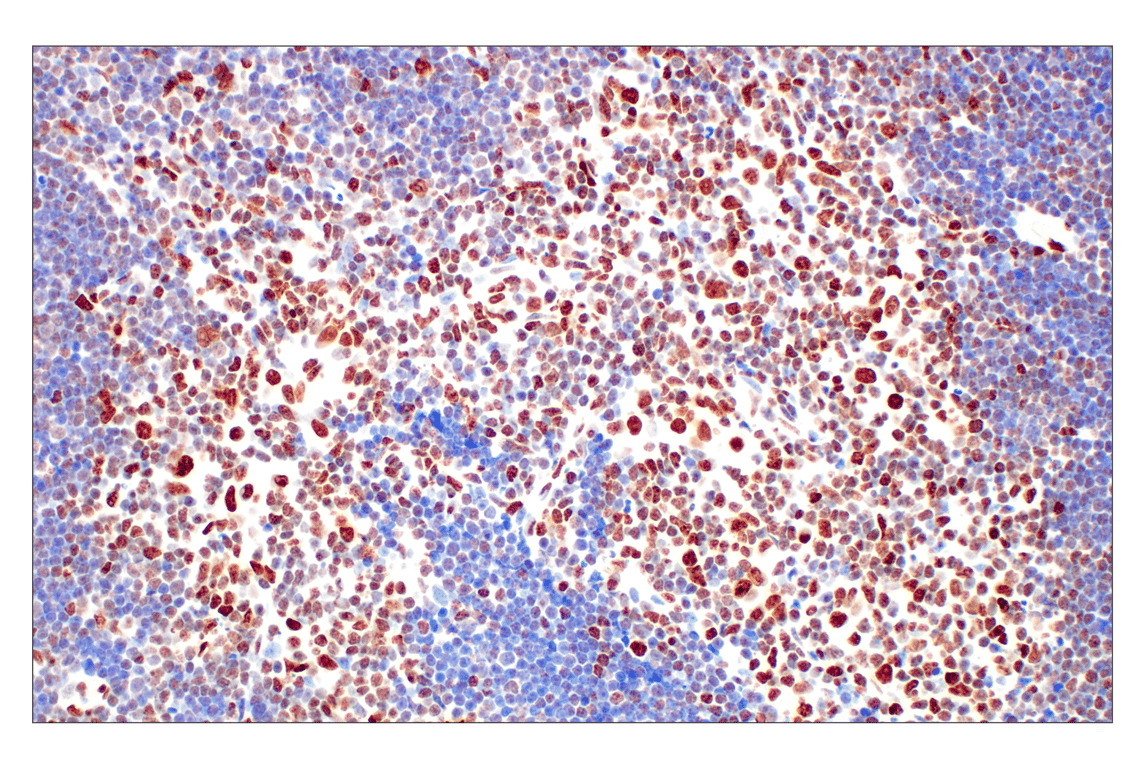Immunohistochemistry Image 2: Tri-Methyl-Histone H3 (Lys27) (C36B11) Rabbit Monoclonal Antibody (BSA and Azide Free)