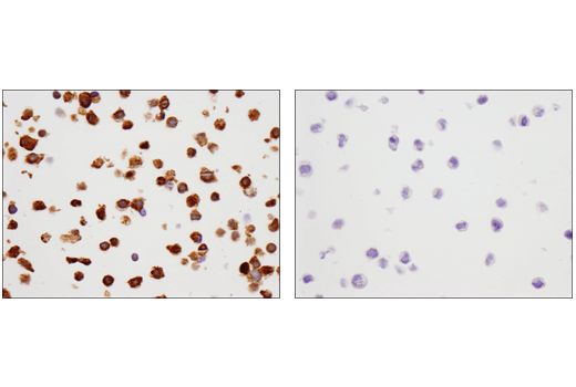 Immunohistochemistry Image 3: SMAD4 (D3R4N) Rabbit Monoclonal Antibody