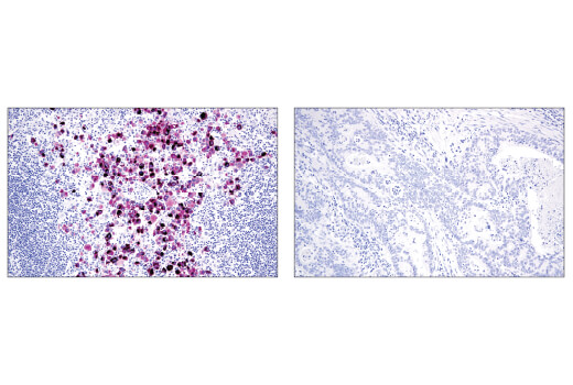 Immunohistochemistry Image 2: MLANA/MART-1 (E9Q4O) Rabbit Monoclonal Antibody