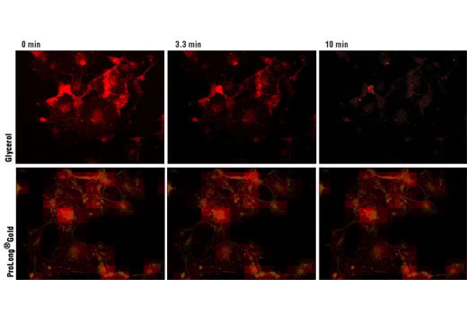 Immunofluorescence Image 2: ProLong Gold Antifade Reagent with DAPI