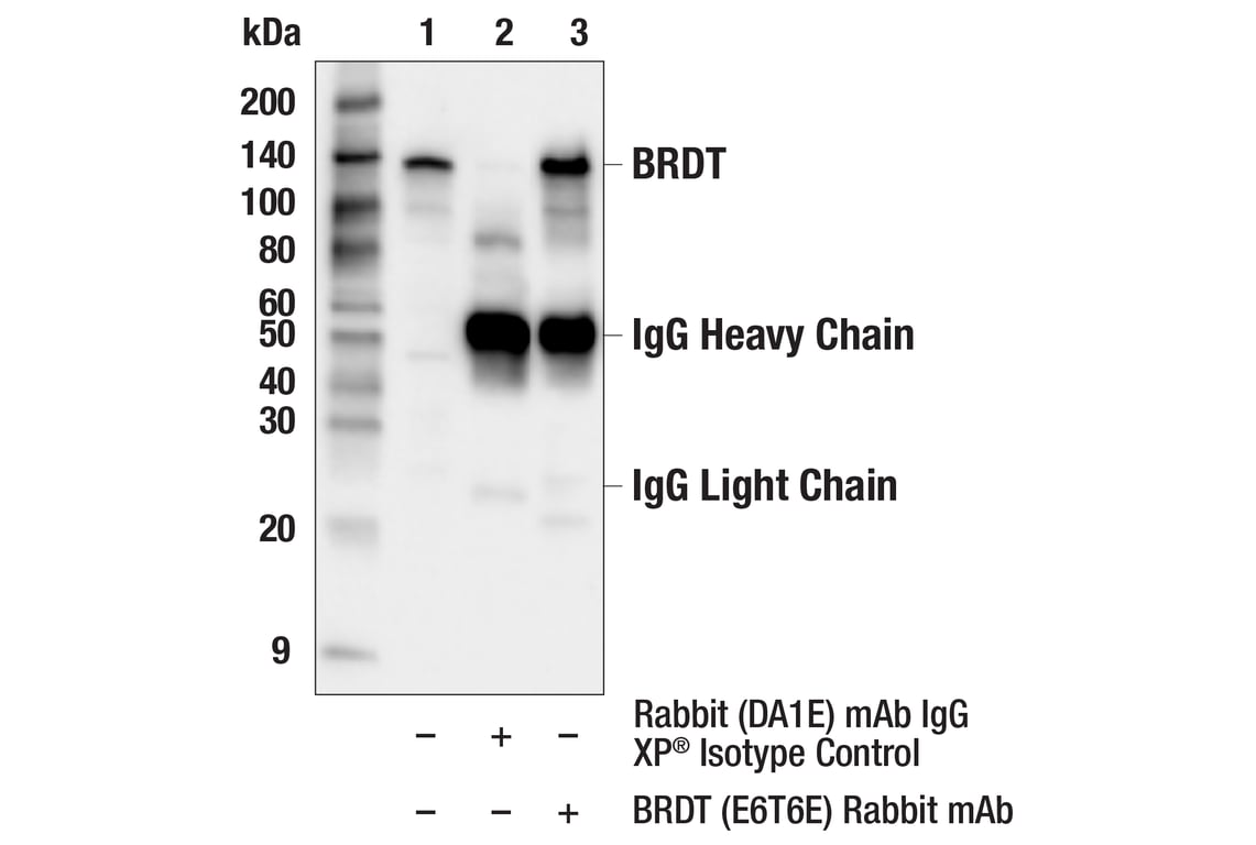 Immunoprecipitation Image 1: BRDT (E6T6E) Rabbit Monoclonal Antibody