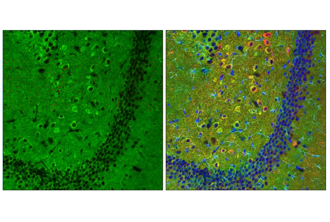 Immunofluorescence Image 3: Phospho-Tau (Thr205) (E8Q5Z) Mouse Monoclonal Antibody (BSA and Azide Free)