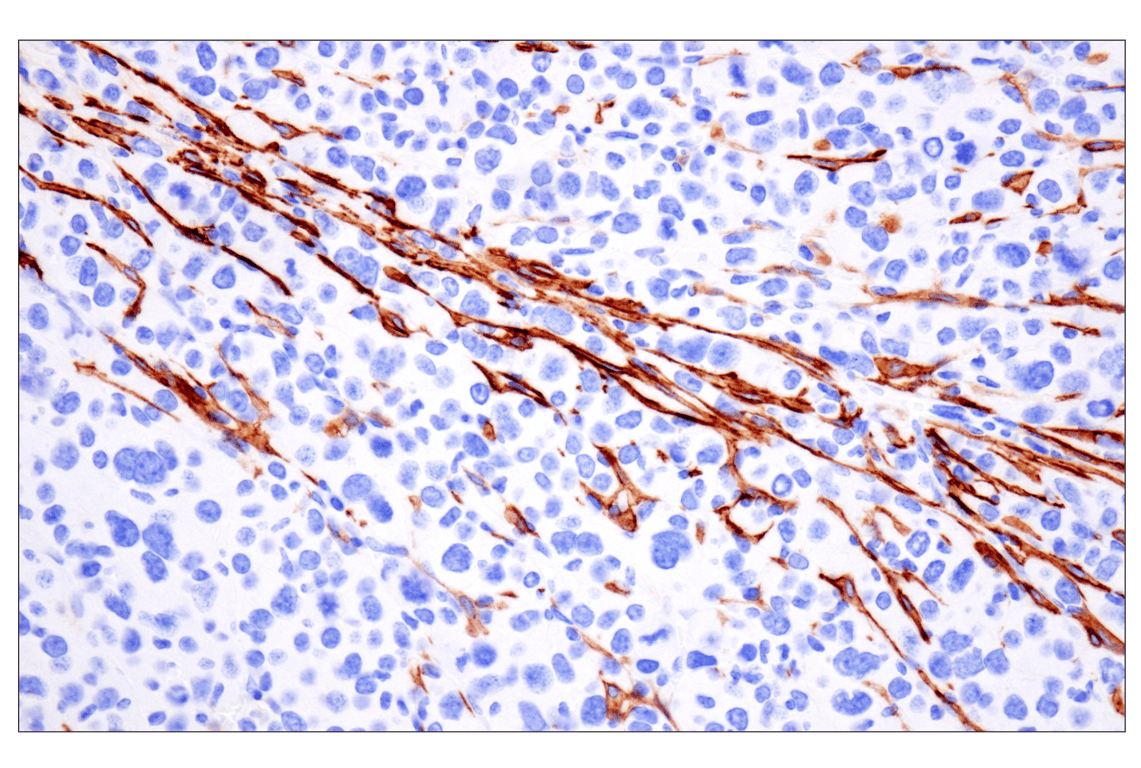 Immunohistochemistry Image 6: LRRC15 (E4X8J) Rabbit Monoclonal Antibody