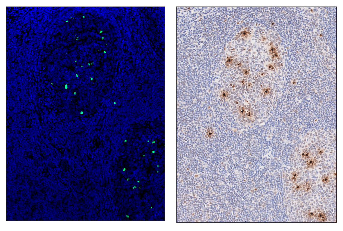 Immunohistochemistry Image 6: Phospho-Histone H2A.X (Ser139) (D7T2V) & CO-0135-488 SignalStar<sup>™</sup> Oligo-Antibody Pair