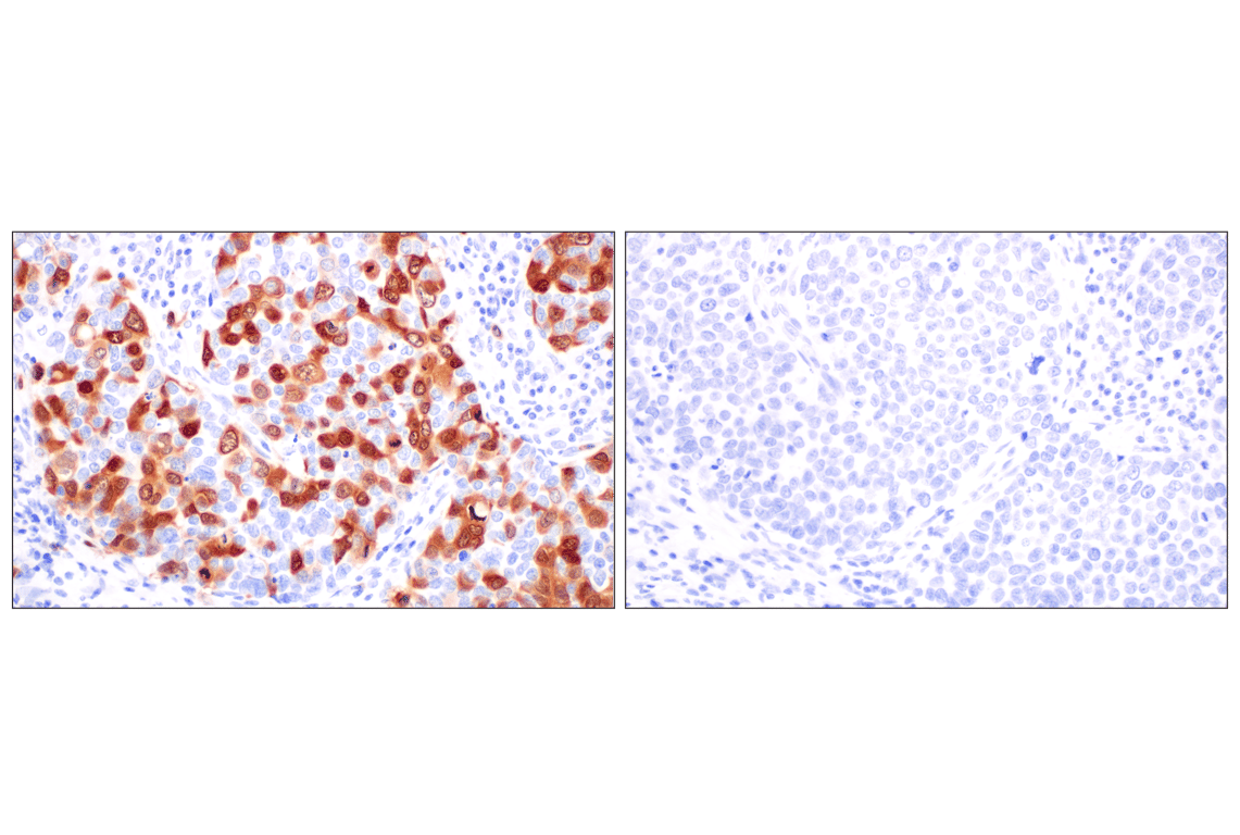 Immunohistochemistry Image 9: Thymidine Kinase 1 (E2H7Z) Rabbit Monoclonal Antibody