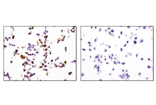 Immunohistochemistry Image 3: PC2 (D1E1S) Rabbit Monoclonal Antibody
