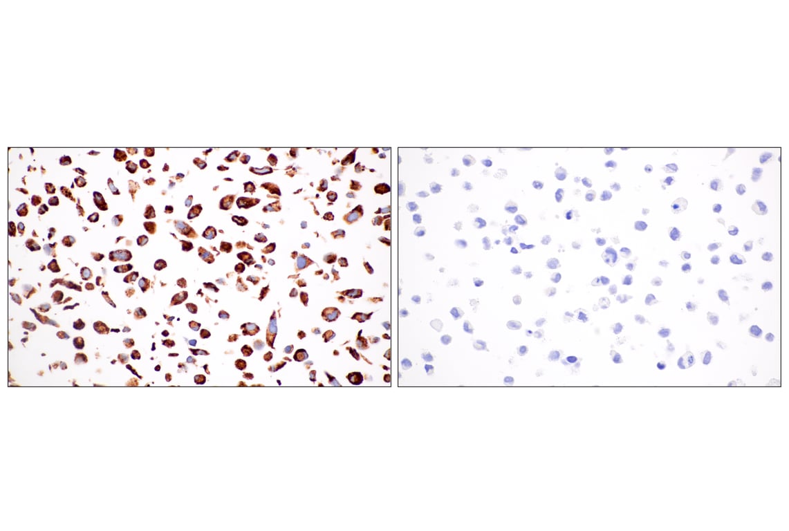 Immunohistochemistry Image 7: HSP47/SERPINH1 (E4A8P) Rabbit Monoclonal Antibody