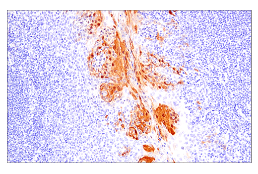 Immunohistochemistry Image 3: S100A7 (E7X2C) Rabbit Monoclonal Antibody